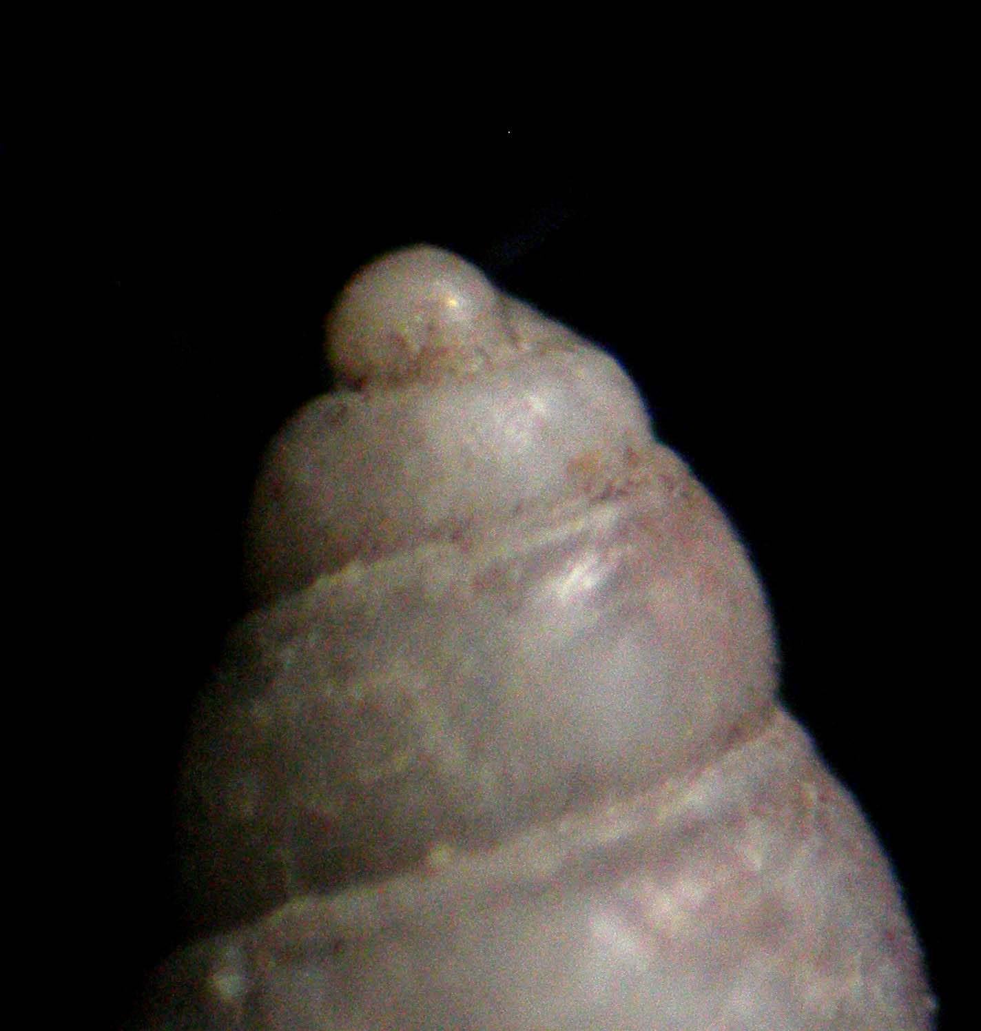 odostomia????????